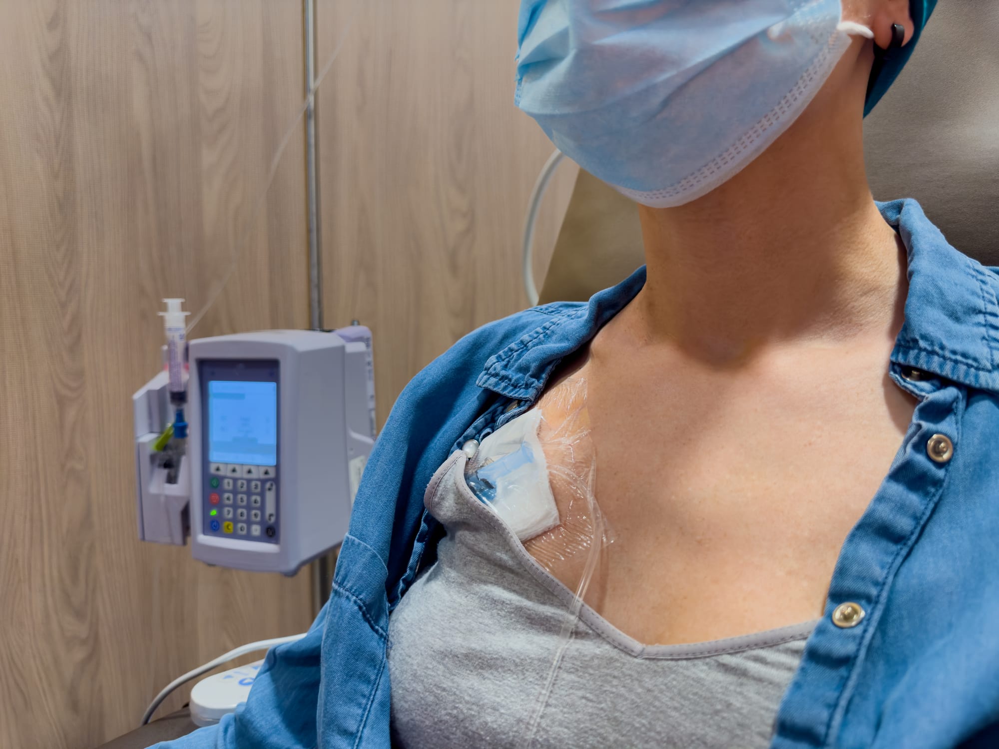 A woman with a chemo port getting cancer treatment