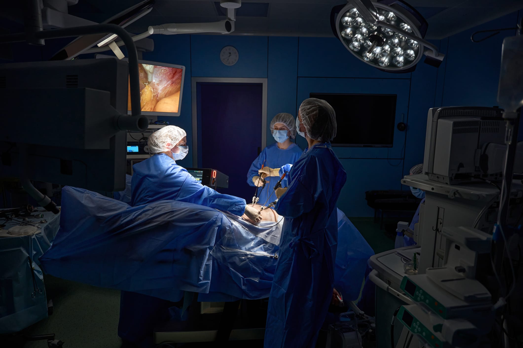 Surgeons in the operating room with a patient during laparoscopic surgery in hospital
