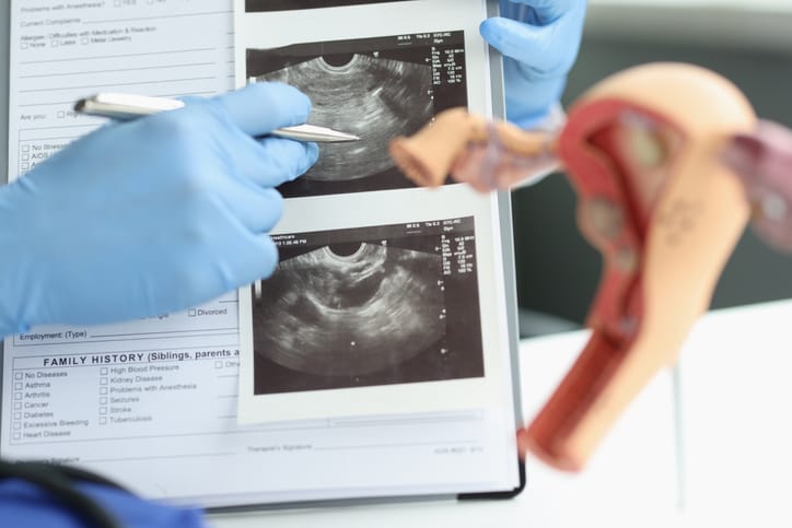Photo shows a doctor pointing at ultrasound images of the ovaries and vagina/Getty Images