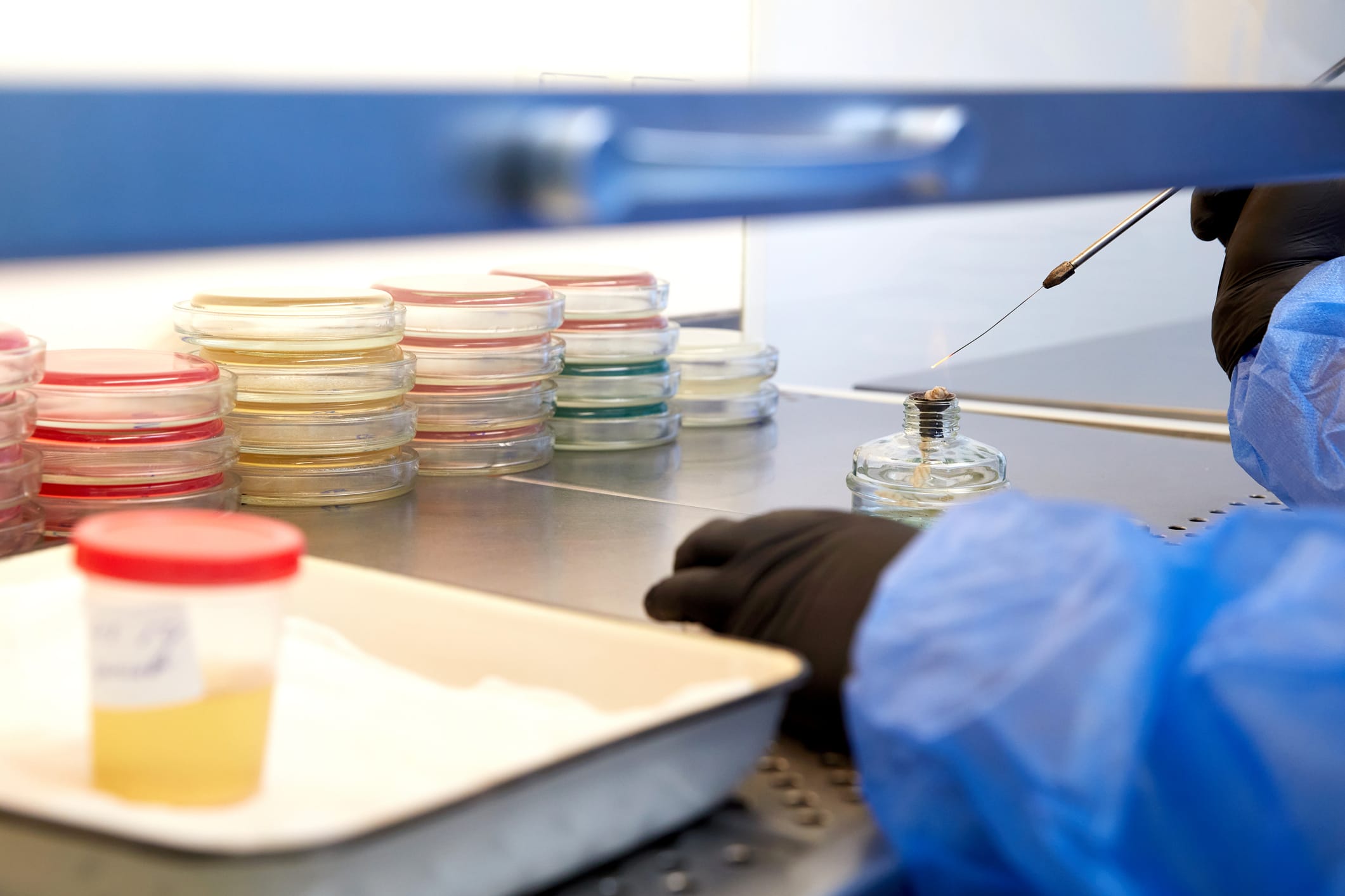 medical technologist doing urine test in medical laboratory wearing protective uniform.